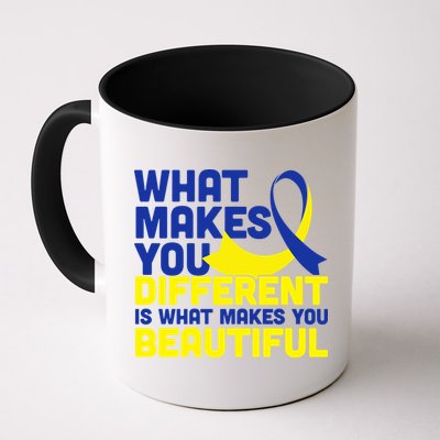 What Makes You Different Down Syndrome Awareness Mug