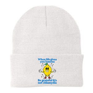 When Life Gives You Lemons Be Grateful ItS Not Chlamydia Knit Cap Winter Beanie