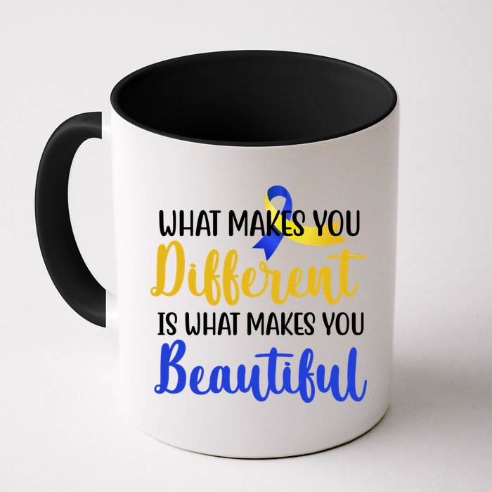 What Makes You Different Is What Makes You Beautiful Down Syndrome Mug