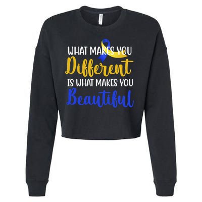 What Makes You Different Is What Makes You Beautiful Down Syndrome Cropped Pullover Crew