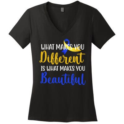 What Makes You Different Is What Makes You Beautiful Down Syndrome Women's V-Neck T-Shirt