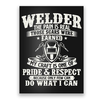 Welder The Pain Is Real Those Scars Were Earned Welding Poster