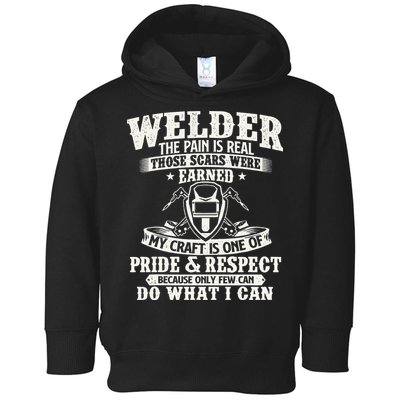 Welder The Pain Is Real Those Scars Were Earned Welding Toddler Hoodie