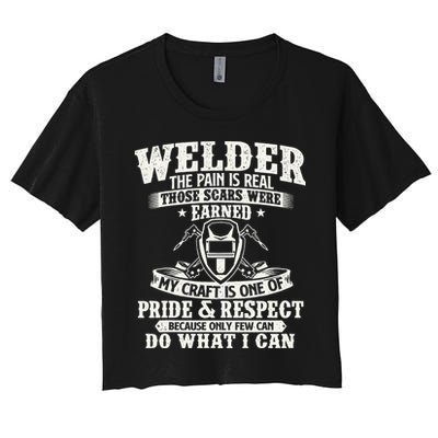 Welder The Pain Is Real Those Scars Were Earned Welding Crop Top