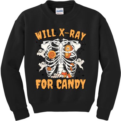 Will Xray For Candy Halooween Rad Tech Kids Sweatshirt