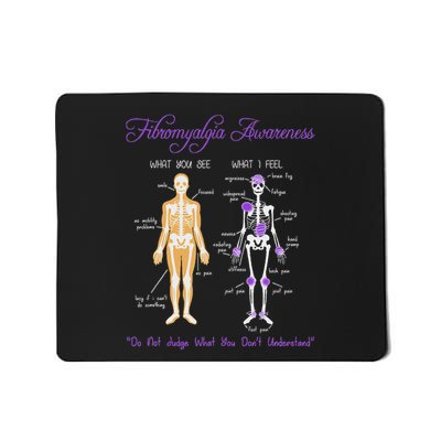 What You See What I Feel Skeleton Fibromyalgia Awareness Mousepad
