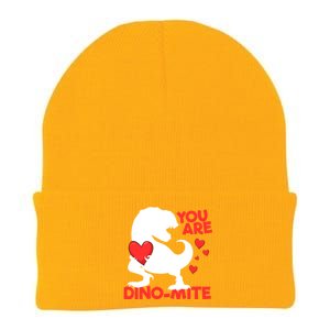 You Are Dinogiftmite Tgiftrex Dinosaur Valentines Day Trex Cool Gift Knit Cap Winter Beanie