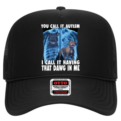 You Call It Autism I Call It Having That Dawg In Me Trucker Hat