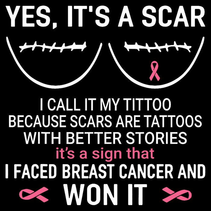 Yes ItS A Scar I Call It My Tittoo Pom Pom 12in Knit Beanie