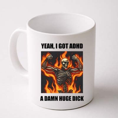 Yeah I Got Adhd A Damn Huge Dick Mug