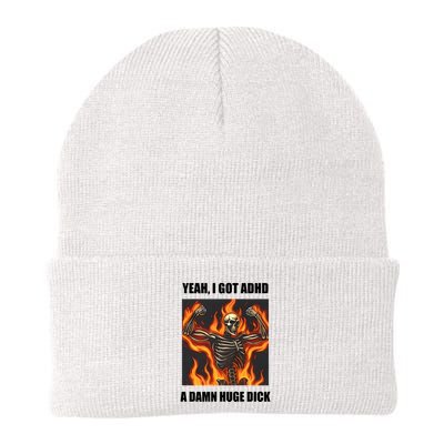 Yeah I Got Adhd A Damn Huge Dick Beanie