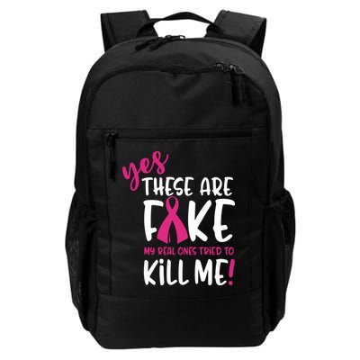 Yes These Are Fake My Real Ones Tried To Kill Me Backpack