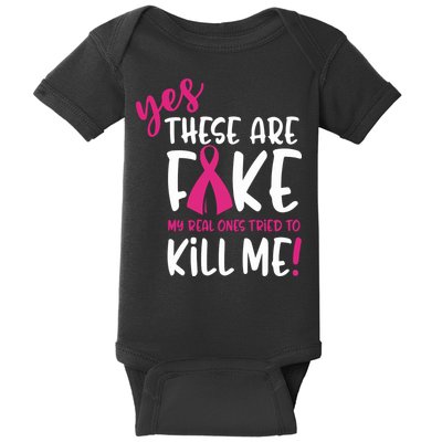 Yes These Are Fake My Real Ones Tried To Kill Me Baby Bodysuit